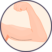arm lift image